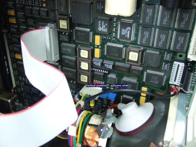 hp4957afacetransplant2.jpg