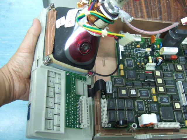 hp4957afacetransplant9.jpg